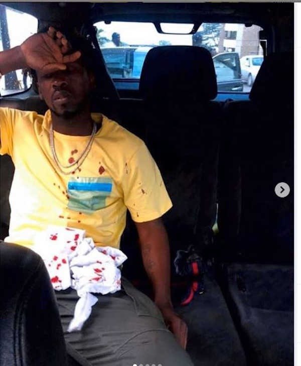 Orezi To Sue Bolt For 100 Million Over Car Accident