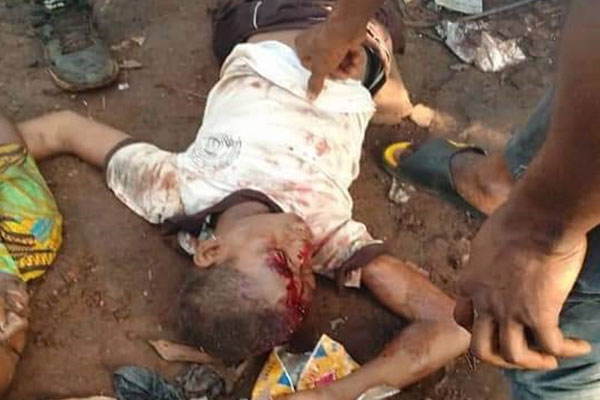 Truck Rams Into Primary School Bus, Kills Scores Of Pupils (PHOTOS)