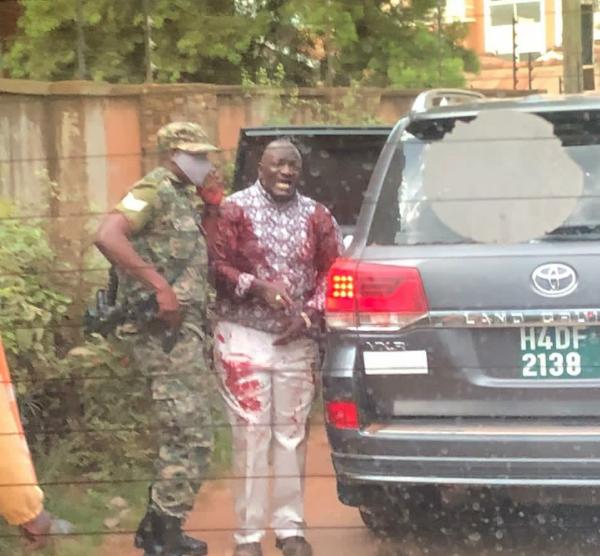 Ugandan General Injured As Gunmen Sprayed His Land Cruiser SUV, Daughter, Driver Killed - autojosh 