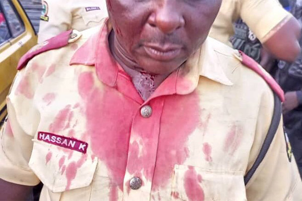 Danfo Driver Stabbed LASTMA Official In The Head, Took To His Heels - autojosh 